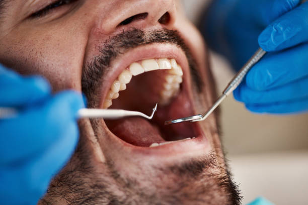 Best Broken or Chipped Tooth Repair in Orfordville, WI